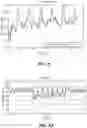 Fig. 04 - Methods and systems for lowering blood pressure through reduction of ventricle filling