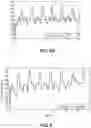 Fig. 05 - Methods and systems for lowering blood pressure through reduction of ventricle filling