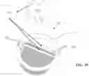 Fig. 12 - Methods and systems for lowering blood pressure through reduction of ventricle filling