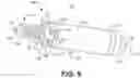 Fig. 10 - Capture in ventricle-from-atrium cardiac therapy