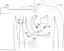 Fig. 01 - Cardiac therapy system using subcutaneously sensed p-waves for resynchronization pacing management