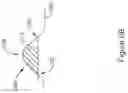 Fig. 07 - Cardiac therapy system using subcutaneously sensed p-waves for resynchronization pacing management