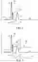 Fig. 10 - Multi-threshold sensing of cardiac electrical signals in an extracardiovascular implantable cardioverter defibrillator