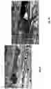 Fig. 09 - WATER SOLUBLE ANIONIC BACTERIOCHLOROPHYLL DERIVATIVES AND THEIR USES