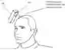 Fig. 01 - Systems and Methods for Treating Androgenetic Alopecia