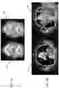 Fig. 08 - Systems and methods for delivering radiotherapy