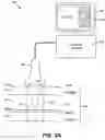 Fig. 03 - System and method for noninvasive skin tightening