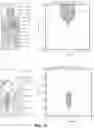 Fig. 28 - System and method for noninvasive skin tightening