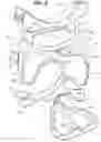 Fig. 06 - Joint separator for body alignment