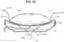 Fig. 09 - Joint separator for body alignment