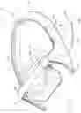 Fig. 45 - Joint separator for body alignment