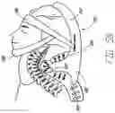 Fig. 46 - Joint separator for body alignment