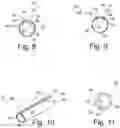 Fig. 05 - Grip assemblies and related methods