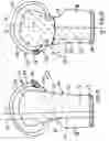 Fig. 09 - SOFTBALL PITCHING THIGH PAD