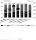 Fig. 02 - Catalyst system for dewaxing