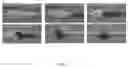 Fig. 05 - MICROFLUIDIC CHIP FOR SEPARATING AND DETECTING WHOLE BLOOD SAMPLE AND DETECTION METHOD THEREOF
