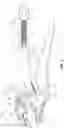 Fig. 04 - Locking pliers