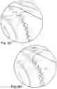 Fig. 10 - Reversible Ratcheting Tool With Dual Pawls
