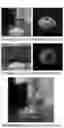 Fig. 08 - PIGMENT-FREE COLOR CONTACT LENS COMPRISING A MICRO-PATTERN HAVING PHOTONIC CRYSTAL STRUCTURE