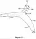 Fig. 04 - Wheel alignment mechanism