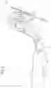 Fig. 06 - Vehicle seat comprising fitting arrangement and locking device