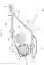 Fig. 03 - Airbag