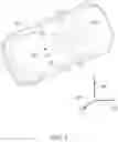Fig. 02 - Sensor dirtiness detection