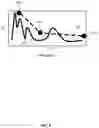 Fig. 05 - Steering instability detection