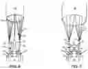 Fig. 05 - Head restraint for parachute assemblies