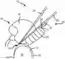 Fig. 01 - Inflatable head restraint for parachutes