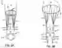 Fig. 06 - Seat back head restrain for parachute assemblies