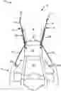 Fig. 01 - Systems for removal of parachute assembly head restraints