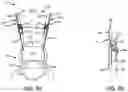Fig. 05 - Systems for removal of parachute assembly head restraints