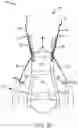 Fig. 06 - Systems for removal of parachute assembly head restraints