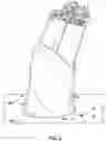 Fig. 03 - Refuse bag insertion device and method