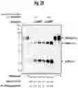 Fig. 30 - SITE-SELECTIVE FUNCTIONALIZATION OF PROTEINS USING TRACELESS AFFINITY LABELS