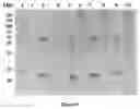 Fig. 07 - Process for the purification of recombinant antibody fragments