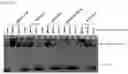 Fig. 04 - RNA-binding protein