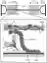 Fig. 01 - Methods and compositions for rapidly replacing cardiac myosin binding protein-C in sarcomeres