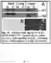 Fig. 25 - Micro-dystrophins and related methods of use
