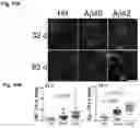 Fig. 11 - STEM CELL MODEL OF APOE GENOTYPE AND Abeta42-DEPENDENT NEURODEGENERATION AND METHODS OF USING THE SAME