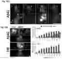 Fig. 12 - STEM CELL MODEL OF APOE GENOTYPE AND Abeta42-DEPENDENT NEURODEGENERATION AND METHODS OF USING THE SAME