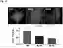 Fig. 15 - STEM CELL MODEL OF APOE GENOTYPE AND Abeta42-DEPENDENT NEURODEGENERATION AND METHODS OF USING THE SAME