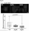 Fig. 16 - STEM CELL MODEL OF APOE GENOTYPE AND Abeta42-DEPENDENT NEURODEGENERATION AND METHODS OF USING THE SAME