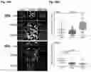 Fig. 20 - STEM CELL MODEL OF APOE GENOTYPE AND Abeta42-DEPENDENT NEURODEGENERATION AND METHODS OF USING THE SAME