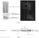 Fig. 04 - Engineered opsonin for pathogen detection and treatment