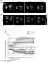 Fig. 11 - Prevention of tissue ischemia and related methods