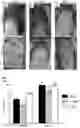 Fig. 12 - Prevention of tissue ischemia and related methods