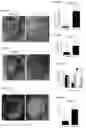 Fig. 16 - Prevention of tissue ischemia and related methods