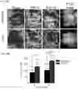 Fig. 17 - Prevention of tissue ischemia and related methods